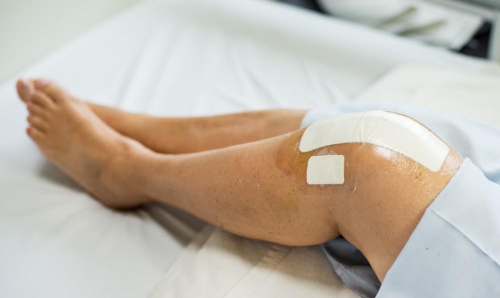 Total Knee Replacement Recovery And What To Know About It?