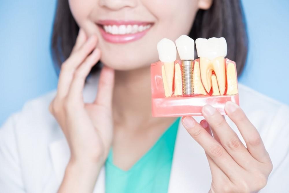What To Consider When Getting Dental Implants
